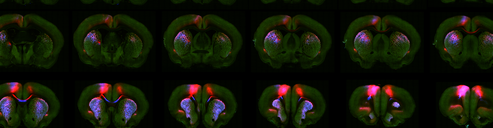 Erlich lab brain imaging