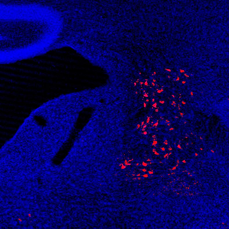 Neurons that project to the spinal cord