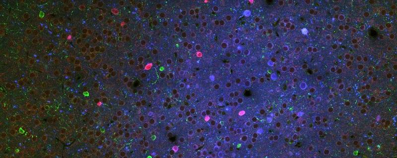 Neurons