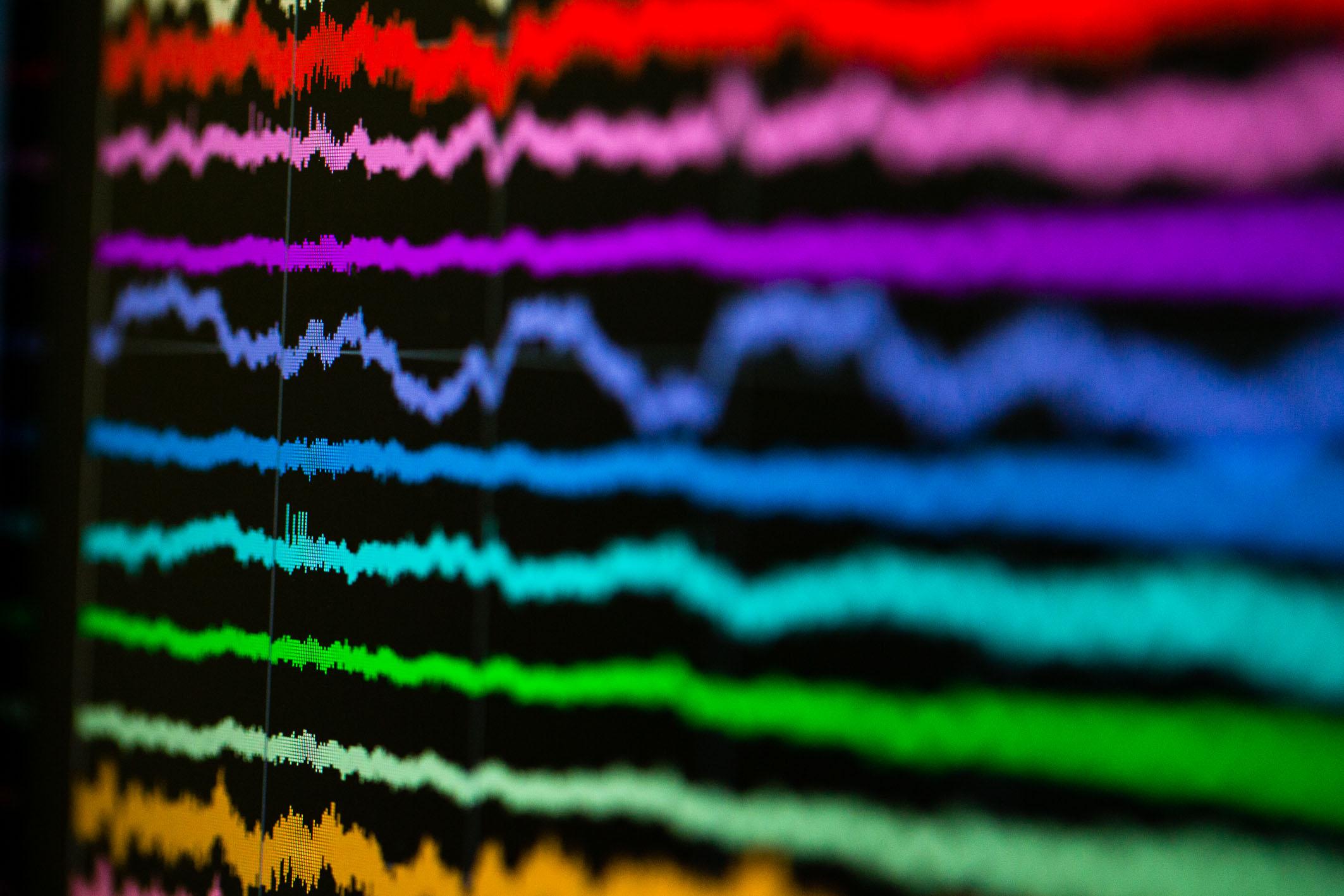 Local field potential (LFP) traces recorded from the microwires with neuronal action potentials superposed.