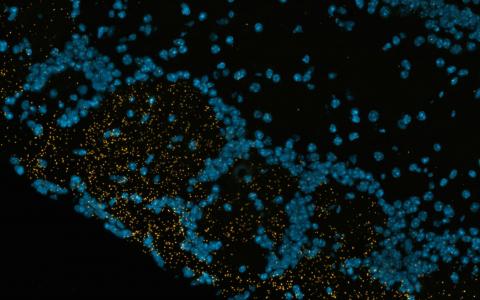 The structure of part of the olfactory bulb in the brain