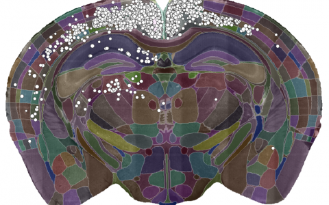 A single slice of the 3D image showing the detected cells (white dots) and the brain divided into regions (coloured sections).