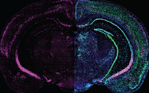 Brain slice - GRP expression (left) different cell markers (right)