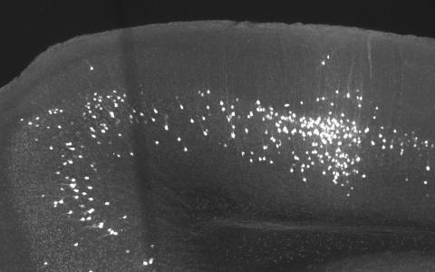 Presynaptic partners of primary visual cortical neurons extending to secondary visual and retrosplenial cortical regions