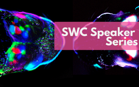 M1. Cortical spontaneous activity at birth in a control mouse (left) and a mouse where retinal waves were blocked by carbenoxolone injection into the eye (right). Text overlaid SWC Speaker Series