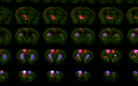 Erlich lab brain imaging