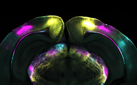 BRain slice showing projects in yellow, pink and blue