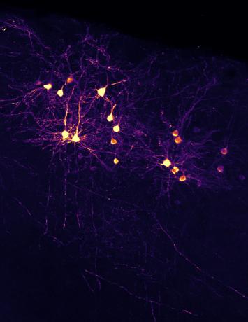 Primary visual cortex neurons projecting to higher visual area AL